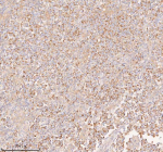 Immunohistochemical staining of COQ8B using anti-COQ8B antibody. COQ8B was detected in a paraffin-embedded section of human testicular seminoma tissue. Heat mediated antigen retrieval was performed in EDTA buffer (pH 8.0, epitope retrieval solution). The tissue section was blocked with 10% goat serum. The tissue section was then incubated with 2 ug/ml rabbit anti-COQ8B antibody overnight at 4oC. Peroxidase Conjugated Goat Anti-rabbit IgG was used as secondary antibody and incubated for 30 minutes at 37oC. The tissue section was developed using an HRP secondary and DAB substrate.