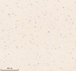 Immunohistochemical staining of UBE2W using anti-UBE2W antibody. UBE2W was detected in a paraffin-embedded section of rat brain tissue. Heat mediated antigen retrieval was performed in EDTA buffer (pH 8.0, epitope retrieval solution). The tissue section was blocked with 10% goat serum. The tissue section was then incubated with 2 ug/ml rabbit anti-UBE2W antibody overnight at 4oC. Peroxidase Conjugated Goat Anti-rabbit IgG was used as secondary antibody and incubated for 30 minutes at 37oC. The tissue section was developed using an HRP secondary and DAB substrate.