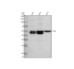 TYMP Antibody Multi-Sample WB. Western blot analysis of human whole cell lysates using TYMP antibody detecting thymidine phosphorylase. Lane 1: human whole cell lysate, Lane 2: SiHa whole cell lysate, Lane 3: THP-1 whole cell lysate. A predominant band is detected at approximately 50 kDa in all samples, slightly below the predicted ~55 kDa molecular weight but consistent with the known migration behavior of TYMP. A weaker band is also observed in the high 40 kDa range, likely representing a processed or partially cleaved form of the protein. The consistent detection across samples aligns with TYMP expression as a cytosolic enzyme involved in nucleotide metabolism and angiogenesis-associated signaling.