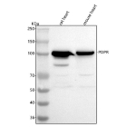 Western blot analysis of PDPR using anti-PDPR antibody. Lane 1: rat heart tissue lysates, Lane 2: mouse heart tissue lysates. After electrophoresis, proteins were transferred to a nitrocellulose membrane at 150 mA for 50-90 minutes. Blocked the membrane with 5% non-fat milk/TBS for 1.5 hour at RT. The membrane was incubated with rabbit anti-PDPR antibody at 0.5 ug/ml overnight at 4oC, then washed with TBS-0.1%Tween 3 times with 5 minutes each and probed with a goat anti-rabbit IgG-HRP secondary antibody at a dilution of 1:5000 for 1.5 hour at RT. The signal was developed using enhanced chemiluminescent. A specific band was detected for PDPR at approximately 99 kDa. The expected molecular weight of PDPR is ~99 kDa.