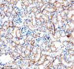 Immunohistochemical staining of CARD10 using anti-CARD10 antibody. CARD10 was detected in a paraffin-embedded section of mouse kidney tissue. Heat mediated antigen retrieval was performed in EDTA buffer (pH 8.0, epitope retrieval solution). The tissue section was blocked with 10% goat serum. The tissue section was then incubated with 2 ug/ml rabbit anti-CARD10 antibody overnight at 4oC. Peroxidase Conjugated Goat Anti-rabbit IgG was used as secondary antibody and incubated for 30 minutes at 37oC. The tissue section was developed using an HRP secondary and DAB substrate.