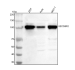 Western blot analysis of SECISBP2 using anti-SECISBP2 antibody. Lane 1: human 293T whole cell lysates, Lane 2: human Hela whole cell lysates, Lane 3: human MCF-7 whole cell lysates. After electrophoresis, proteins were transferred to a nitrocellulose membrane at 150 mA for 50-90 minutes. Blocked the membrane with 5% non-fat milk/TBS for 1.5 hour at RT. The membrane was incubated with rabbit anti-SECISBP2 antibody at 0.5 ug/ml overnight at 4oC, then washed with TBS-0.1%Tween 3 times with 5 minutes each and probed with a goat anti-rabbit IgG-HRP secondary antibody at a dilution of 1:5000 for 1.5 hour at RT. The signal was developed using enhanced chemiluminescent. A dominant band at ~100 kDa is observed, consistent with the known upward size shift of SECISBP2 relative to its predicted 95 kDa mass. A second closely spaced band is present in all samples, likely representing phosphorylated or other post-translationally modified isoforms of SECISBP2. The banding pattern agrees with published reports describing SECISBP2 migration at ~100-110 kDa with multiple modified species.