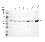 Western blot analysis of AHCY using anti-AHCY antibody. Electrophoresis was performed on a 10% SDS-PAGE gel at 80V (Stacking gel) / 120V (Resolving gel) for 2 hours. Lane 1: human Hela whole cell lysates, Lane 2: human HepG2 whole cell lysates, Lane 3: human whole cell lysates, Lane 4: human Jurkat whole cell lysates, Lane 5: rat liver tissue lysates, Lane 6: rat thymus tissue lysates, Lane 7: mouse liver tissue lysates. After electrophoresis, proteins were transferred to a nitrocellulose membrane at 150 mA for 50-90 minutes. Blocked the membrane with 5% non-fat milk/TBS for 1.5 hour at RT. The membrane was incubated with rabbit anti-AHCY antibody at 0.5 ug/ml overnight at 4oC, then washed with TBS-0.1%Tween 3 times with 5 minutes each and probed with a goat anti-rabbit IgG-HRP secondary antibody at a dilution of 1:5000 for 1.5 hour at RT. The signal was developed using an ECL Plus Western Blotting Substrate. A predominant band is detected at approximately 43 kDa in all samples, slightly below the predicted ~48 kDa size but consistent with the apparent molecular weight of endogenous S adenosylhomocysteine hydrolase under these electrophoresis conditions.