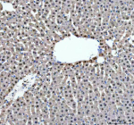 Immunohistochemical staining of AHCY using anti-AHCY antibody. AHCY was detected in a paraffin-embedded section of rat liver tissue. Heat mediated antigen retrieval was performed in EDTA buffer (pH 8.0, epitope retrieval solution). The tissue section was blocked with 10% goat serum. The tissue section was then incubated with 2 ug/ml rabbit anti-AHCY antibody overnight at 4oC. Peroxidase Conjugated Goat Anti-rabbit IgG was used as secondary antibody and incubated for 30 minutes at 37oC. The tissue section was developed using an HRP secondary and DAB substrate.