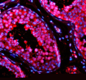 Immunofluorescent staining of TSN using anti-Translin antibody (red). TSN was detected in a paraffin-embedded section of human testis tissue. Heat mediated antigen retrieval was performed in EDTA buffer (pH 8.0, epitope retrieval solution). The tissue section was blocked with 10% goat serum. The tissue section was then incubated with 5 ug/ml rabbit anti-Translin antibody overnight at 4oC. Cy3 Conjugated Goat Anti-Rabbit IgG was used as secondary antibody at 1:500 dilution and incubated for 30 minutes at 37oC. The section was counterstained with DAPI nuclear stain (blue). Visualize using a fluorescence microscope and filter sets appropriate for the label used.