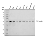 Western blot analysis of TSN using anti-Translin antibody. Electrophoresis was performed on a 12% SDS-PAGE gel at 80V (Stacking gel) / 120V (Resolving gel) for 2 hours. Lane 1: human Jurkat whole cell lysates, Lane 2: human Hela whole cell lysates, Lane 3: human MOLT-4 whole cell lysates, Lane 4: human 293T whole cell lysates, Lane 5: rat brain tissue lysates, Lane 6: rat RH35 whole cell lysates, Lane 7: mouse brain tissue lysates, Lane 8: mouse NIH/3T3 whole cell lysates. After electrophoresis, proteins were transferred to a nitrocellulose membrane at 150 mA for 50-90 minutes. Blocked the membrane with 5% non-fat milk/TBS for 1.5 hour at RT. The membrane was incubated with rabbit anti-Translin antibody at 0.5 ug/ml overnight at 4oC, then washed with TBS-0.1%Tween 3 times with 5 minutes each and probed with a goat anti-rabbit IgG-HRP secondary antibody at a dilution of 1:5000 for 1.5 hour at RT. The signal was developed using an ECL Plus Western Blotting Substrate. A specific band was detected for TSN at approximately 26 kDa. The expected molecular weight of TSN is ~26 kDa.