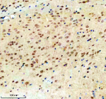 Immunohistochemical staining of TSN using anti-Translin antibody. TSN was detected in a paraffin-embedded section of mouse brain tissue. Heat mediated antigen retrieval was performed in EDTA buffer (pH 8.0, epitope retrieval solution). The tissue section was blocked with 10% goat serum. The tissue section was then incubated with 2 ug/ml rabbit anti-Translin antibody overnight at 4oC. Peroxidase Conjugated Goat Anti-rabbit IgG was used as secondary antibody and incubated for 30 minutes at 37oC. The tissue section was developed using an HRP secondary and DAB substrate.