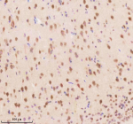 Immunohistochemical staining of TSN using anti-Translin antibody. TSN was detected in a paraffin-embedded section of rat brain tissue. Heat mediated antigen retrieval was performed in EDTA buffer (pH 8.0, epitope retrieval solution). The tissue section was blocked with 10% goat serum. The tissue section was then incubated with 2 ug/ml rabbit anti-Translin antibody overnight at 4oC. Peroxidase Conjugated Goat Anti-rabbit IgG was used as secondary antibody and incubated for 30 minutes at 37oC. The tissue section was developed using an HRP secondary and DAB substrate.