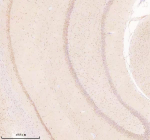 Immunohistochemical staining of TSN using anti-Translin antibody. TSN was detected in a paraffin-embedded section of rat brain tissue. Heat mediated antigen retrieval was performed in EDTA buffer (pH 8.0, epitope retrieval solution). The tissue section was blocked with 10% goat serum. The tissue section was then incubated with 2 ug/ml rabbit anti-Translin antibody overnight at 4oC. Peroxidase Conjugated Goat Anti-rabbit IgG was used as secondary antibody and incubated for 30 minutes at 37oC. The tissue section was developed using an HRP secondary and DAB substrate.