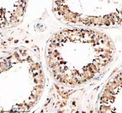 Immunohistochemical staining of TSN using anti-Translin antibody. TSN was detected in a paraffin-embedded section of human testis tissue. Heat mediated antigen retrieval was performed in EDTA buffer (pH 8.0, epitope retrieval solution). The tissue section was blocked with 10% goat serum. The tissue section was then incubated with 2 ug/ml rabbit anti-Translin antibody overnight at 4oC. Peroxidase Conjugated Goat Anti-rabbit IgG was used as secondary antibody and incubated for 30 minutes at 37oC. The tissue section was developed using an HRP secondary and DAB substrate.