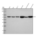 Western blot analysis of MATK using anti-MATK antibody. Lane 1: human K562 whole cell lysates, Lane 2: human HEL whole cell lysates, Lane 3: human MCF-7 whole cell lysates, Lane 4: rat brain tissue lysates, Lane 5: mouse thymus tissue lysates, Lane 6: mouse brain tissue lysates. After electrophoresis, proteins were transferred to a nitrocellulose membrane at 150 mA for 50-90 minutes. Blocked the membrane with 5% non-fat milk/TBS for 1.5 hour at RT. The membrane was incubated with rabbit anti-MATK antibody at 0.25 ug/ml overnight at 4oC, then washed with TBS-0.1%Tween 3 times with 5 minutes each and probed with a goat anti-rabbit IgG-HRP secondary antibody at a dilution of 1:5000 for 1.5 hour at RT. The signal was developed using enhanced chemiluminescent. The expected molecular weight of MATK is ~56 kDa.