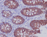 KRT20 Antibody for IHC. Immunohistochemistry analysis of paraffin-embedded human colon tissue using KRT20 antibody. HRP-DAB brown chromogenic staining highlights cytoplasmic Keratin 20 / Cytokeratin 20 (KRT20) expression in colonic epithelial cells lining the glandular structures, while surrounding stromal cells remain largely negative. The staining pattern reflects the expected epithelial localization of this intermediate filament protein in gastrointestinal mucosa.