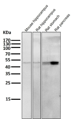 Western blot testing of mouse and rat samples using the KRT20 antibody at 1:5000 dilution for 1 hour at room temperature. The expected molecular weight of KRT20 is at 46 kDa.