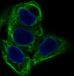 Immunofluorescent analysis of human Hela cells using KRT20 antibody (green) and DAPI nuclear stain (blue).