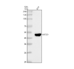 Western blot analysis of Cytokeratin 20 using anti-KRT20 antibody. Lane 1: human RT4 whole cell lysates. After electrophoresis, proteins were transferred to a nitrocellulose membrane at 150 mA for 50-90 minutes. Blocked the membrane with 5% non-fat milk/TBS for 1.5 hour at RT. The membrane was incubated with rabbit anti-KRT20 antibody at 1:1000 overnight at 4oC, then washed with TBS-0.1%Tween 3 times with 5 minutes each and probed with a goat anti-rabbit IgG-HRP secondary antibody at a dilution of 1:500 for 1.5 hour at RT. The signal was developed using enhanced chemiluminescent. The expected molecular weight of KRT20 is at 46 kDa.