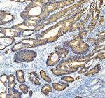 Immunohistochemical staining of Cytokeratin 20 using anti-KRT20 antibody. KRT20 was detected in a paraffin-embedded section of human appendix tissue. Heat mediated antigen retrieval was performed in EDTA buffer (pH 8.0, epitope retrieval solution). The tissue section was blocked with 10% goat serum. The tissue section was then incubated with 2 ug/ml rabbit anti-KRT20 antibody overnight at 4oC. Peroxidase Conjugated Goat Anti-rabbit IgG was used as secondary antibody and incubated for 30 minutes at 37oC. The tissue section was developed using an HRP secondary and DAB substrate.