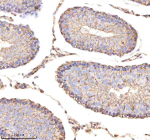 Immunohistochemical staining of ENO1 using anti-ENO1 antibody. ENO1 was detected in a paraffin-embedded section of rat testis tissue. Heat mediated antigen retrieval was performed in EDTA buffer (pH 8.0, epitope retrieval solution). The tissue section was blocked with 10% goat serum. The tissue section was then incubated with 2 ug/ml rabbit anti-ENO1 antibody overnight at 4oC. Peroxidase Conjugated Goat Anti-rabbit IgG was used as secondary antibody and incubated for 30 minutes at 37oC. The tissue section was developed using an HRP secondary and DAB substrate.