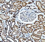 BCKDH E2 Antibody staining of human kidney by IHC. Immunohistochemistry of FFPE human kidney sections using the BCKDH E2 Antibody at 2 ug/ml. Strong granular brown cytoplasmic staining is prominent within renal tubular epithelial cells, while glomerular structures show comparatively little staining. Nuclei are counterstained blue and remain largely negative. Heat-mediated antigen retrieval was performed in pH 8 EDTA before antibody incubation. The predominantly cytoplasmic pattern is consistent with the mitochondrial localization of DBT and demonstrates tissue detection of dihydrolipoamide branched-chain transacylase E2 with this DBT Antibody.