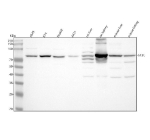 GCLC Antibody Multi-Species WB. Western blot analysis using GCLC Antibody / Glutathione Biosynthesis Antibody demonstrates strong immunoreactive bands at approximately 73 kDa in human HeLa, Jurkat, and HepG2 cell lysates, as well as rat brain, rat C6, and mouse brain samples. The observed molecular weight is consistent with the predicted size of Glutamate-Cysteine Ligase Catalytic Subunit (GCLC), the catalytic component of the rate-limiting enzyme in glutathione biosynthesis. Consistent detection across human, rat, and mouse samples supports recognition of a conserved GCLC epitope and demonstrates broad species reactivity. Additional lower molecular weight bands observed in selected samples are consistent with previously reported truncated or proteolytically processed forms of GCLC. The observed immunoreactivity demonstrates the utility of this antibody for studies of glutathione metabolism, oxidative stress responses, antioxidant defense pathways, cellular detoxification, and redox regulation.