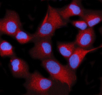 Immunofluorescent staining of STIM2 using anti-STIM2 antibody (red). STIM2 was detected in an immunocytochemical section of human HeLa cells. Enzyme antigen retrieval was performed using IHC enzyme antigen retrieval reagent for 15 mins. The cells were blocked with 10% goat serum. And then incubated with 5 ug/ml rabbit anti-STIM2 antibody overnight at 4oC. Cy3 Conjugated Goat Anti-Rabbit IgG was used as secondary antibody at 1:500 dilution and incubated for 30 minutes at 37oC. The section was counterstained with DAPI nuclear stain (blue). Visualize using a fluorescence microscope and filter sets appropriate for the label used.