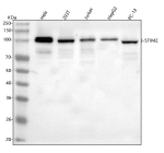 Western blot analysis of STIM2 using anti-STIM2 antibody. Lane 1: human Hela whole cell lysates, Lane 2: human 293T whole cell lysates, Lane 3: human Jurkat whole cell lysates, Lane 4: human HepG2 whole cell lysates, Lane 5: rat PC-12 whole cell lysates. After electrophoresis, proteins were transferred to a nitrocellulose membrane at 150 mA for 50-90 minutes. Blocked the membrane with 5% non-fat milk/TBS for 1.5 hour at RT. The membrane was incubated with rabbit anti-STIM2 antibody at 0.5 ug/ml overnight at 4oC, then washed with TBS-0.1%Tween 3 times with 5 minutes each and probed with a goat anti-rabbit IgG-HRP secondary antibody at a dilution of 1:5000 for 1.5 hour at RT. The signal was developed using enhanced chemiluminescent. STIM2 antibody detects a predominant band at approximately 100 kDa in human HeLa, 293T, Jurkat, and HepG2 lysates, slightly above the 84 kDa theoretical mass but consistent with the 100-115 kDa phosphorylated and glycosylated STIM2 isoforms described in the literature. Rat PC-12 lysate shows a modestly faster migrating band within the same range, in line with species- and phosphorylation-dependent mobility differences.