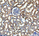 Immunohistochemical staining of HPGD using anti-HPGD antibody. HPGD was detected in a paraffin-embedded section of rat kidney tissue. Heat mediated antigen retrieval was performed in EDTA buffer (pH 8.0, epitope retrieval solution). The tissue section was blocked with 10% goat serum. The tissue section was then incubated with 2 ug/ml rabbit anti-HPGD antibody overnight at 4oC. Peroxidase Conjugated Goat Anti-rabbit IgG was used as secondary antibody and incubated for 30 minutes at 37oC. The tissue section was developed using an HRP secondary and DAB substrate.