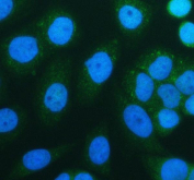 SIRT3 Antibody SiHa Cell IF. Immunofluorescent staining of FFPE human SiHa cells with SIRT3 antibody (green) and DAPI nuclear stain (blue). HIER: steam section in pH6 citrate buffer for 20 min.