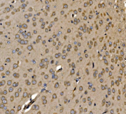 Immunohistochemical staining of FFPE rat brain tissue with SRP72 antibody, HRP-secondary and DAB substrate. HIER: boil tissue sections in pH8 EDTA for 20 min and allow to cool before testing.