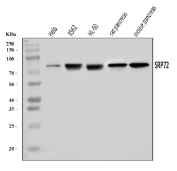 Western blot testing of 1) human HeLa, 2) human K562, 3) human HL60, 4) rat pancreas and 5) mouse pancreas tissue lysate with SRP72 antibody. Predicted molecular weight ~75 kDa, commonly observed at 72-75 kDa.