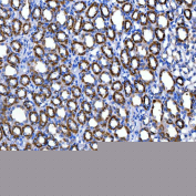Immunohistochemical staining of FFPE rat kidney tissue with SUCLG2 antibody, HRP-secondary and DAB substrate. HIER: boil tissue sections in pH8 EDTA for 20 min and allow to cool before testing.