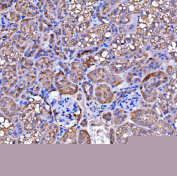 Immunohistochemical staining of FFPE mouse kidney tissue with SUCLG2 antibody, HRP-secondary and DAB substrate. HIER: boil tissue sections in pH8 EDTA for 20 min and allow to cool before testing.