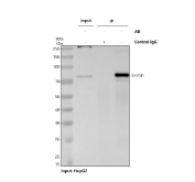 Immunoprecipitation of Synoviolin protein from 500ug of human HepG2 whole cell lysate with 2ug of Synoviolin antibody.