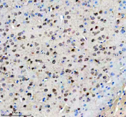 AGO3 Antibody Mouse Brain IHC. Immunohistochemical staining of FFPE mouse brain tissue with AGO3 antibody, HRP-secondary and DAB substrate. HIER: boil tissue sections in pH8 EDTA for 20 min and allow to cool before testing.