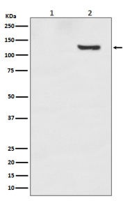 Phospho-SIRT1 (pThr530) Antibody 293T WB. Western blot analysis of phospho-SIRT1 expression in Lane 1: untreated 293T cell lysate and Lane 2: Calyculin A-treated 293T cell lysate using Phospho-SIRT1 (pThr530) Antibody / Stress Signaling Regulator. A phospho-specific band is detected at approximately 120 kDa in treated cells, consistent with phosphorylated Sirtuin 1 / SIRT1 at Thr530. Signal enrichment following phosphatase inhibition with Calyculin A supports phosphorylation-dependent regulation of SIRT1 signaling pathways associated with metabolic stress adaptation and cellular stress-response signaling.
