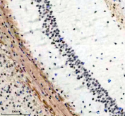 Phospho-SIRT1 (pSer47) Antibody Mouse Brain IHC. Immunohistochemical staining of FFPE mouse brain tissue with Phospho-Sirtuin 1 (pSer47) antibody, HRP-secondary and DAB substrate. HIER: boil tissue sections in pH8 EDTA for 20 min and allow to cool before testing.