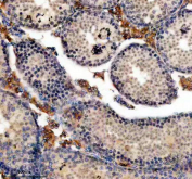 Immunohistochemical staining of FFPE mouse testis tissue with ERCC2 antibody, HRP-secondary and DAB substrate. HIER: boil tissue sections in pH8 EDTA for 20 min and allow to cool before testing.