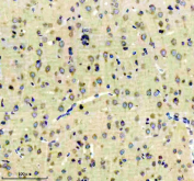 Immunohistochemical staining of FFPE rat brain tissue with EEA1 antibody, HRP-secondary and DAB substrate. HIER: boil tissue sections in pH8 EDTA for 20 min and allow to cool before testing.