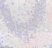 Immunohistochemical staining of FFPE mouse brain tissue with EEA1 antibody, HRP-secondary and DAB substrate. HIER: boil tissue sections in pH8 EDTA for 20 min and allow to cool before testing.