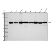 Western blot analysis of USP14 expression in human HeLa, 293T, SK-OV-3, U251, rat RH35 and C6, and mosue Neuro-2a, and RAW264.7 cell lysates using USP14 antibody. A specific band is detected at approximately 60 kDa, consistent with the reported electrophoretic mobility of Ubiquitin carboxyl-terminal hydrolase 14.