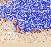 Immunohistochemical staining of rat cerebellum using PRKCG antibody, HRP-secondary and DAB substrate. HIER: boil tissue sections in pH8 EDTA for 20 min and allow to cool before testing. Protein kinase C gamma shows strong cytoplasmic staining in Purkinje neurons localized to the Purkinje cell layer, with minimal staining in the surrounding granular layer.