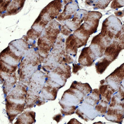 Immunohistochemical staining of FFPE rat skeletal muscle tissue with RAB7A antibody, HRP-secondary and DAB substrate. HIER: boil tissue sections in pH8 EDTA for 20 min and allow to cool before testing.