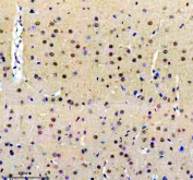Immunohistochemical staining of FFPE rat brain tissue using HIV Tat-specific factor 1 antibody, HRP-secondary and DAB substrate. HIER: boil tissue sections in pH8 EDTA for 20 min and allow to cool before testing.