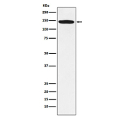Western blot analysis using HIV Tat-specific factor 1 antibody. Lane 1: human Jurkat whole cell lysate. The predicted molecular weight of HIV Tat-specific factor 1 (HTATSF1) is ~86 kDa, while HIV Tat-specific factor 1 antibody detects a prominent band at ~140 kDa on SDS-PAGE, consistent with the commonly reported apparent migration of Tat-SF1 as an approximately 130-140 kDa phosphorylated protein.