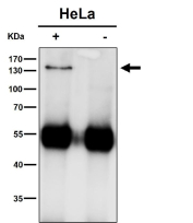 Immunoprecipitation of HIV Tat-specific factor 1 protein from 500ug of human HeLa whole cell lysate with 2ug of HIV Tat-specific factor 1 antibody. The predicted molecular weight of HIV Tat-specific factor 1 (HTATSF1) is ~86 kDa, while HIV Tat-specific factor 1 antibody detects a band at ~140 kDa on SDS-PAGE, consistent with the commonly reported apparent migration of Tat-SF1 as an approximately 130-140 kDa phosphorylated protein.