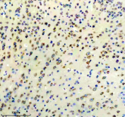 Immunohistochemical staining using DKK3 antibody on paraffin-embedded mouse brain tissue sections. Heat-induced epitope retrieval was performed using EDTA buffer (pH 8.0) prior to antibody incubation. Sections were blocked with 10% goat serum and incubated with DKK3 antibody overnight at 4C. Detection was carried out using an HRP-based secondary antibody with DAB as the chromogen. Staining demonstrates cytoplasmic immunoreactivity in brain tissue. Nuclei were counterstained with hematoxylin.