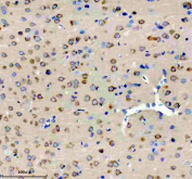 Immunohistochemical staining using DKK3 antibody on paraffin-embedded rat brain tissue sections. Heat-induced epitope retrieval was performed using EDTA buffer (pH 8.0) prior to antibody incubation. Sections were blocked with 10% goat serum and incubated with DKK3 antibody overnight at 4C. Detection was carried out using an HRP-based secondary antibody with DAB as the chromogen. Staining demonstrates cytoplasmic immunoreactivity in brain tissue. Nuclei were counterstained with hematoxylin.