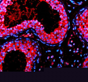 Immunofluorescence staining using PRND antibody on paraffin-embedded human testis tissue sections. Heat-induced epitope retrieval was performed using EDTA buffer (pH 8.0) prior to antibody incubation. Sections were blocked with 10% goat serum and incubated with PRND antibody overnight at 4C. Fluorescent signal was detected using a Cy3-conjugated secondary antibody, and nuclei were counterstained with DAPI. Staining highlights PRND expression within cells of the seminiferous tubules.