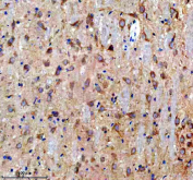 Immunohistochemistry analysis of Doublecortin-like kinase 1 using Doublecortin-like kinase 1 antibody. Doublecortin-like kinase 1 expression was examined in a paraffin-embedded section of rat brain tissue. Heat-mediated antigen retrieval was performed using EDTA buffer (pH 8.0). Tissue sections were blocked with normal goat serum and incubated with Doublecortin-like kinase 1 antibody overnight at 4Â°C. Immunoreactivity was detected using an HRP-based detection system with DAB chromogen, followed by hematoxylin counterstaining.