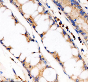 Immunohistochemistry analysis of Phosphodiesterase 4A using PDE4A antibody. Phosphodiesterase 4A expression was examined in a paraffin-embedded section of human colon tissue. Heat-mediated antigen retrieval was performed using EDTA buffer (pH 8.0). Tissue sections were blocked with normal goat serum and incubated with PDE4A antibody overnight at 4Â°C. Immunoreactivity was visualized using an HRP-based detection system with DAB chromogen, followed by hematoxylin counterstaining.