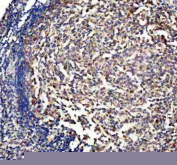 Immunohistochemistry of DUSP2 in human tonsil tissue. DUSP2 expression was examined in a paraffin-embedded section of human tonsil. Heat-mediated antigen retrieval was performed in EDTA buffer (pH 8.0). After blocking with normal serum, the section was incubated with an anti-DUSP2 antibody, followed by an HRP-conjugated secondary antibody and DAB chromogen. Brown staining indicates DUSP2 immunoreactivity, with hematoxylin counterstaining highlighting tissue architecture.